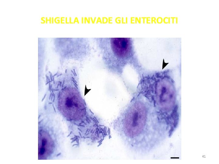 SHIGELLA INVADE GLI ENTEROCITI 41 SHIGELLA INVADE GLI ENTEROCITI 41