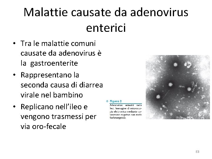 Malattie causate da adenovirus enterici • Tra le malattie comuni causate da adenovirus è Malattie causate da adenovirus enterici • Tra le malattie comuni causate da adenovirus è