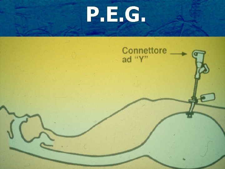 P. E. G. 