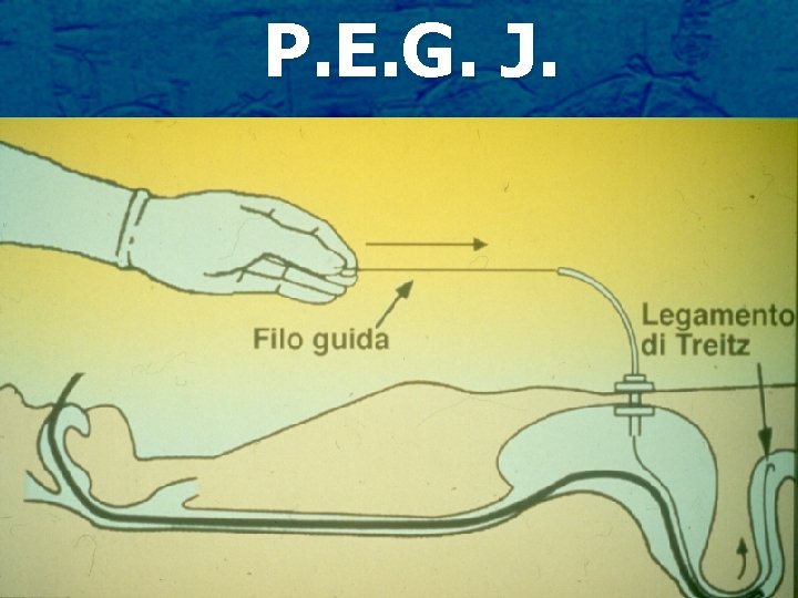 P. E. G. J. 