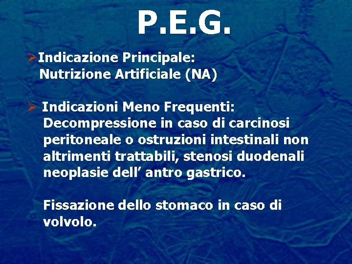 P. E. G. ØIndicazione Principale: Nutrizione Artificiale (NA) Ø Indicazioni Meno Frequenti: Decompressione in