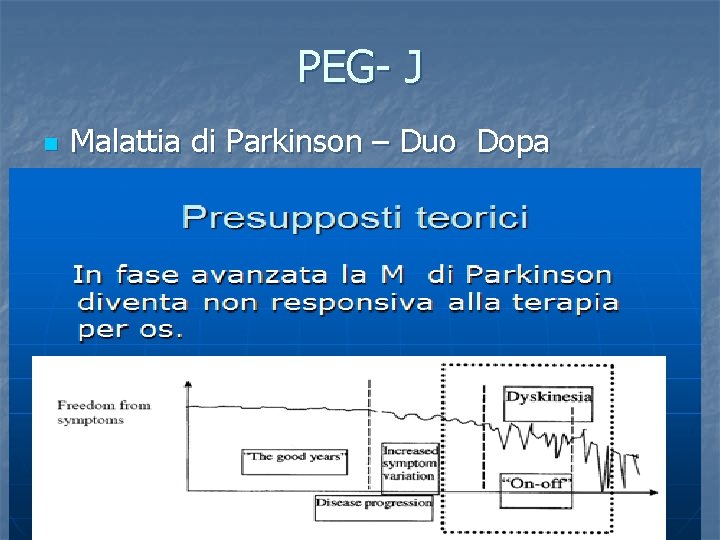 PEG- J n Malattia di Parkinson – Duo Dopa 