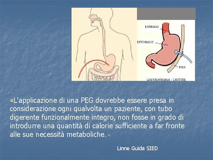  «L'applicazione di una PEG dovrebbe essere presa in considerazione ogni qualvolta un paziente,