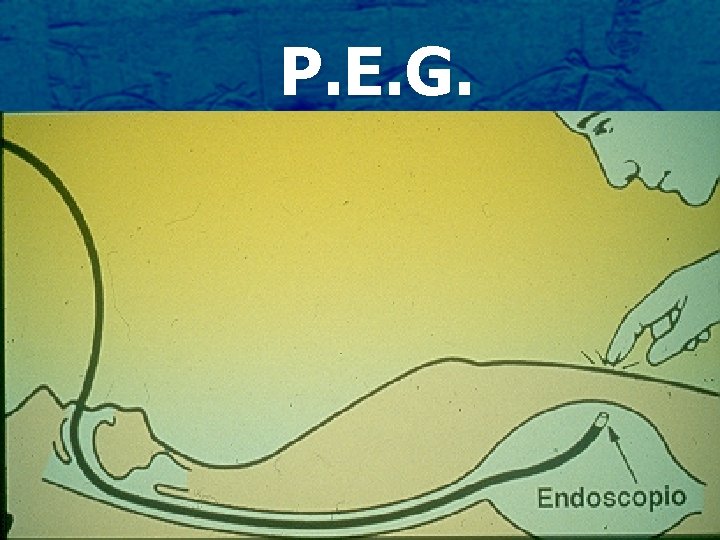 P. E. G. 