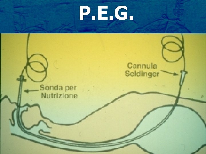 P. E. G. 