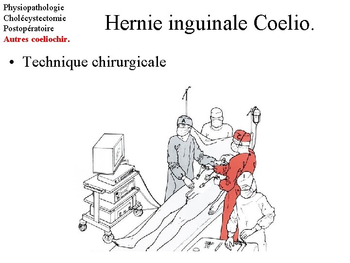 Physiopathologie Cholécystectomie Postopératoire Autres coeliochir. Hernie inguinale Coelio. • Technique chirurgicale 