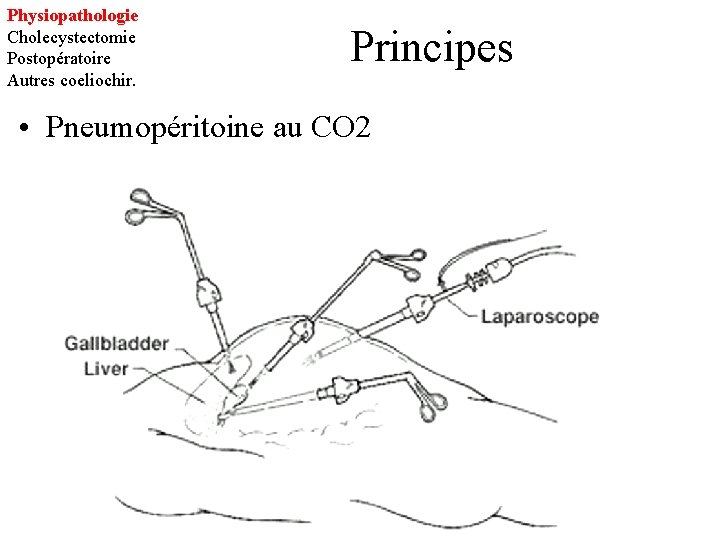 Physiopathologie Cholecystectomie Postopératoire Autres coeliochir. Principes • Pneumopéritoine au CO 2 