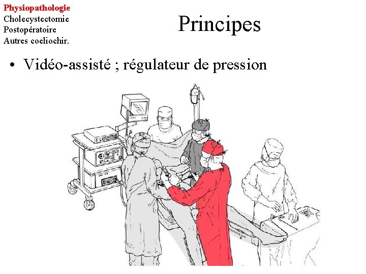 Physiopathologie Cholecystectomie Postopératoire Autres coeliochir. Principes • Vidéo-assisté ; régulateur de pression 