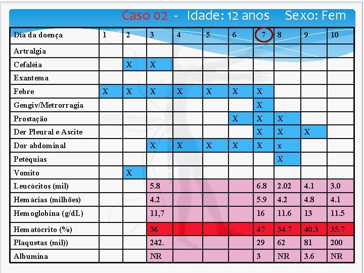 Caso 02 - Idade: 12 anos Sexo: Fem Dia da doença 1 2 3 Caso 02 - Idade: 12 anos Sexo: Fem Dia da doença 1 2 3