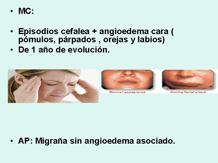  • MC: • Episodios cefalea + angioedema cara ( pómulos, párpados , orejas