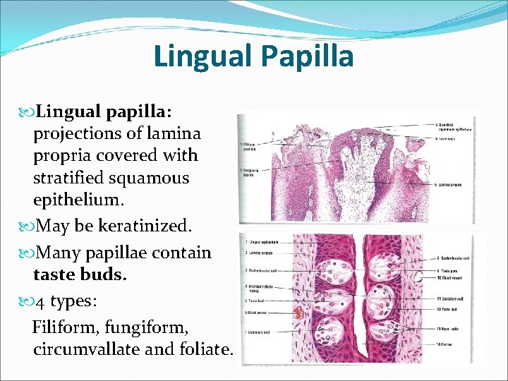 Lingual Papilla Lingual papilla: projections of lamina propria covered with stratified squamous epithelium. May