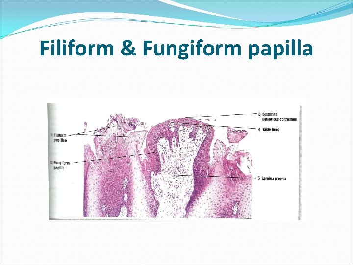 Filiform & Fungiform papilla 