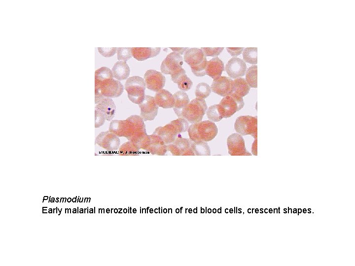 Plasmodium Early malarial merozoite infection of red blood cells, crescent shapes. 