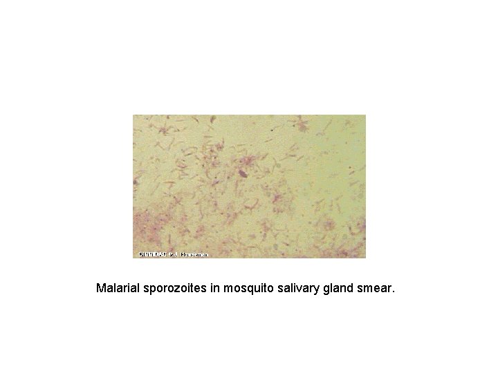 Malarial sporozoites in mosquito salivary gland smear. 
