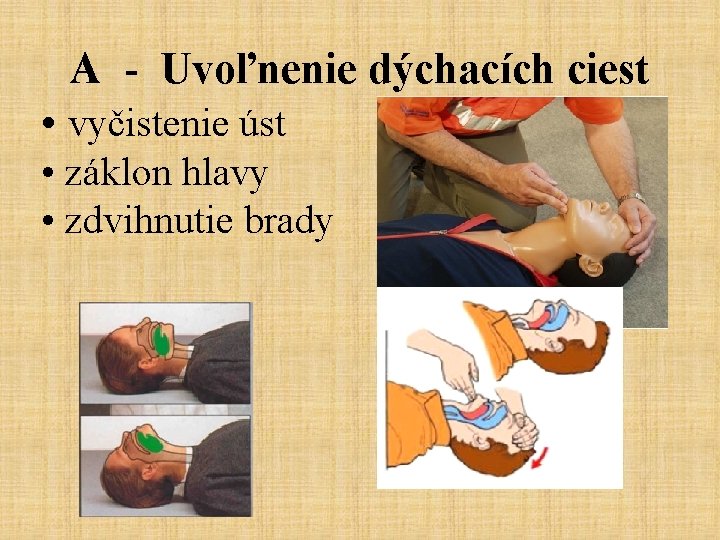 A - Uvoľnenie dýchacích ciest • vyčistenie úst • záklon hlavy • zdvihnutie brady
