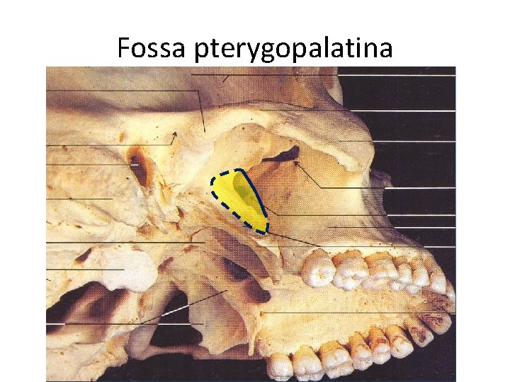 Fossa pterygopalatina 