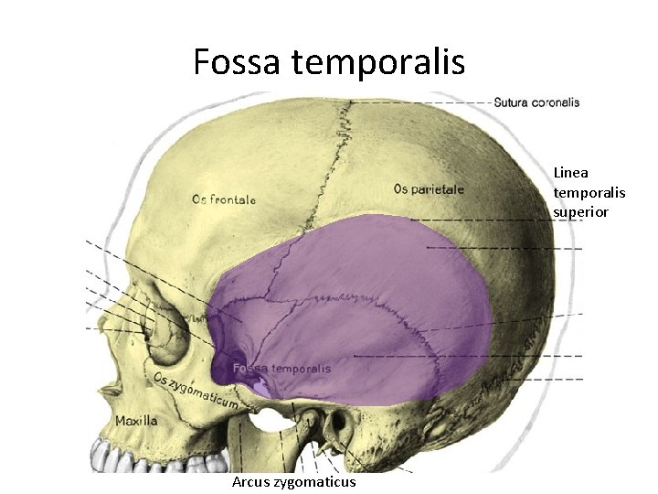 Fossa temporalis Linea temporalis superior Arcus zygomaticus 