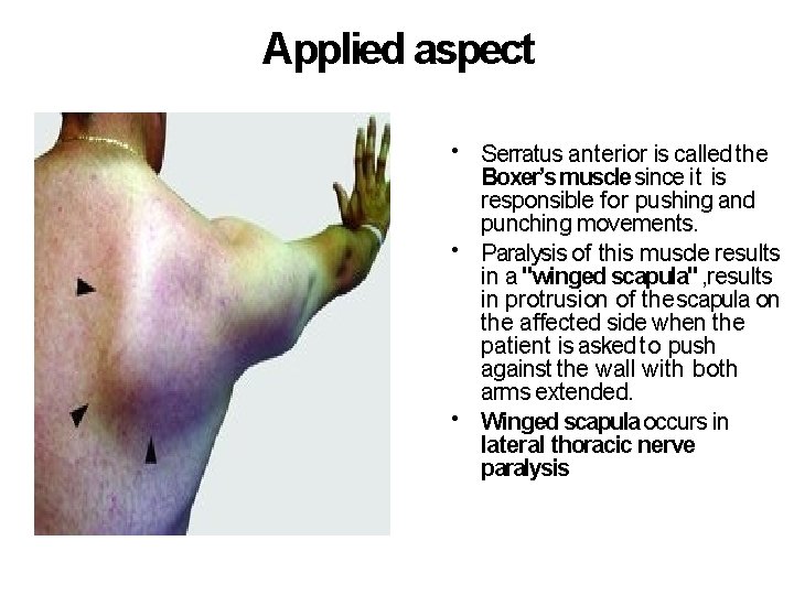 Applied aspect • Serratus anterior is called the Boxer’s muscle since it is responsible