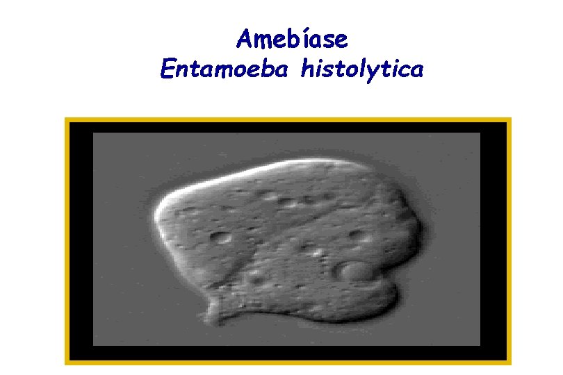 Amebíase Entamoeba histolytica 