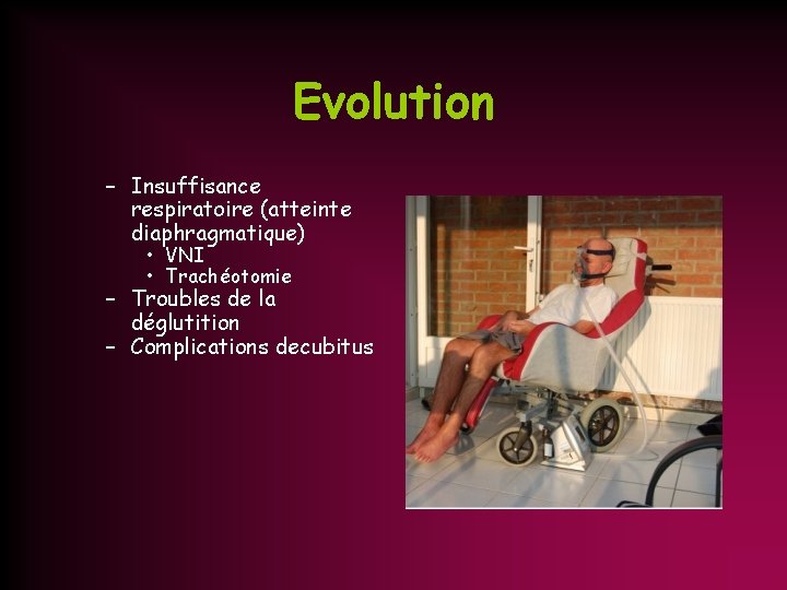 Evolution – Insuffisance respiratoire (atteinte diaphragmatique) • VNI • Trachéotomie – Troubles de la