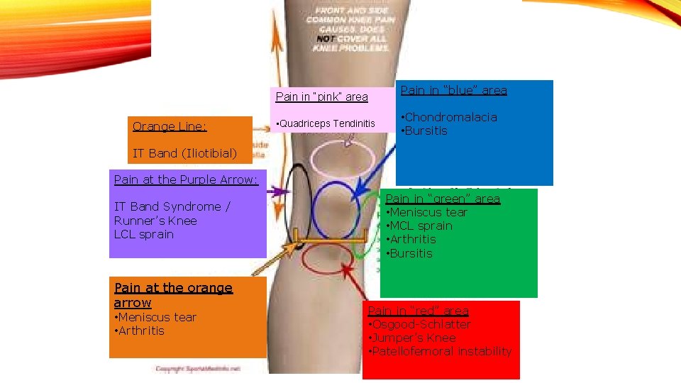 Pain in “blue” area Pain in “pink” area Orange Line: • Quadriceps Tendinitis •