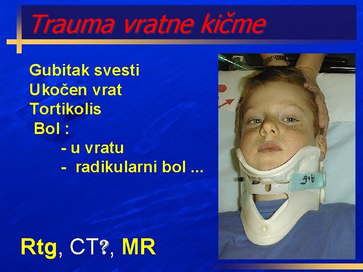 Trauma vratne kičme Gubitak svesti Ukočen vrat Tortikolis Bol : - u vratu -