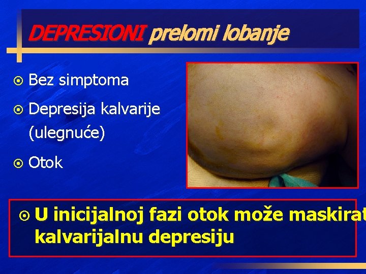 DEPRESIONI prelomi lobanje ¤ Bez simptoma ¤ Depresija kalvarije (ulegnuće) ¤ Otok ¤U inicijalnoj