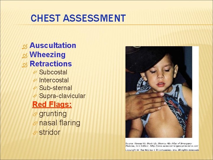 CHEST ASSESSMENT Auscultation Wheezing Retractions Subcostal Intercostal Sub-sternal Supra-clavicular Red Flags: grunting nasal flaring