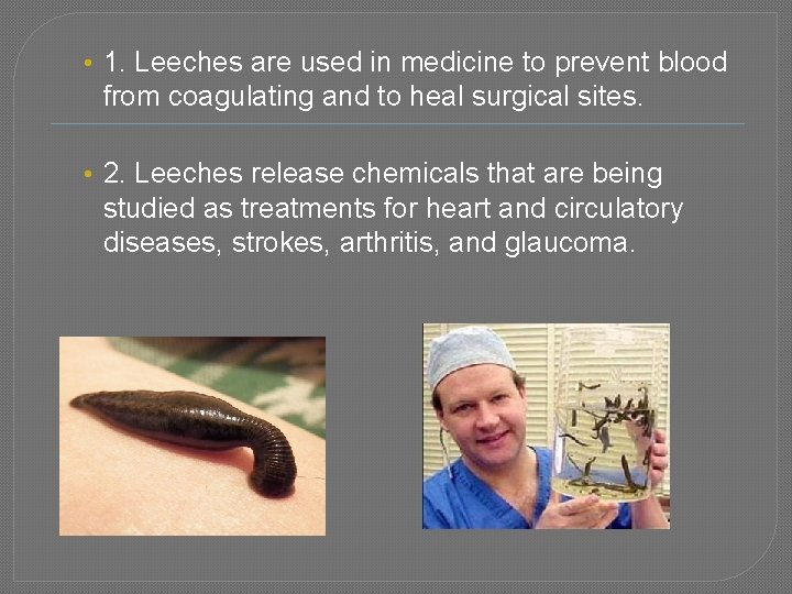  • 1. Leeches are used in medicine to prevent blood from coagulating and