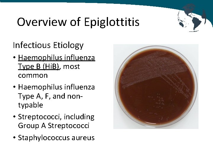 Overview of Epiglottitis Infectious Etiology • Haemophilus influenza Type B (Hi. B), most common