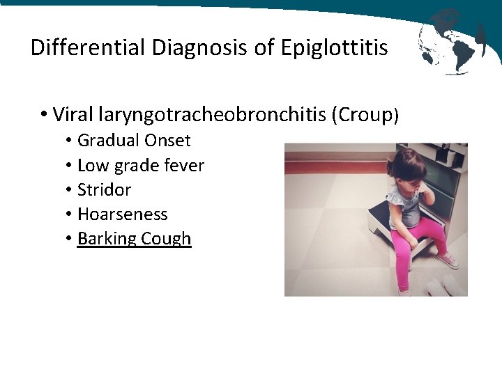 Differential Diagnosis of Epiglottitis • Viral laryngotracheobronchitis (Croup) • Gradual Onset • Low grade