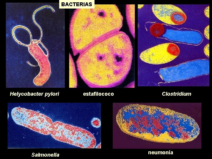 BACTERIAS Helycobacter pylori Salmonella estafilococo Clostridium neumonía 