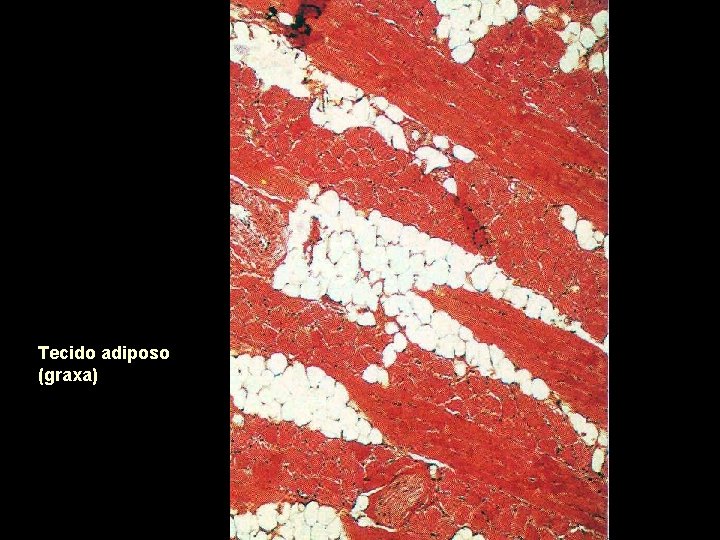 Tecido adiposo (graxa) 