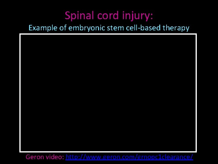 Spinal cord injury: Example of embryonic stem cell-based therapy Geron video: http: //www. geron.