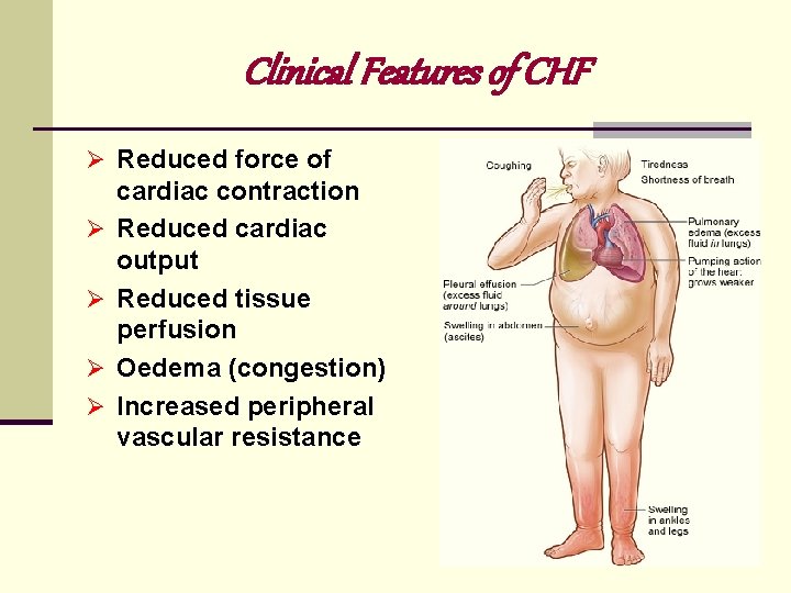 Clinical Features of CHF Ø Reduced force of Ø Ø cardiac contraction Reduced cardiac Clinical Features of CHF Ø Reduced force of Ø Ø cardiac contraction Reduced cardiac