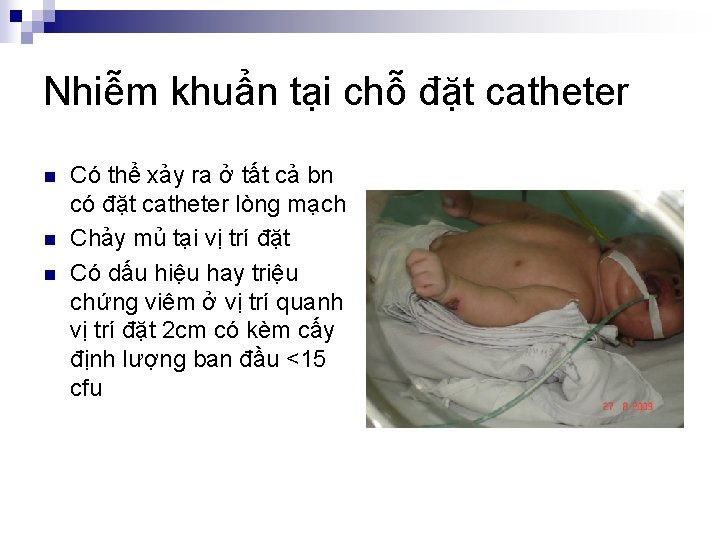 Nhiễm khuẩn tại chỗ đặt catheter n n n Có thể xảy ra ở