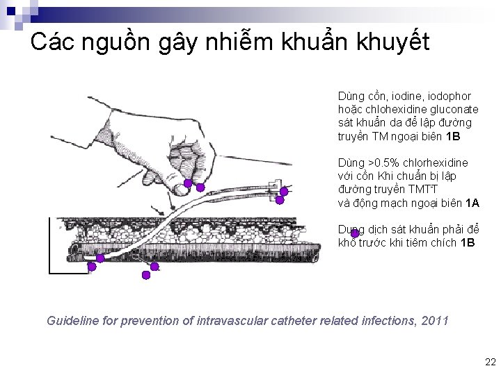 Các nguồn gây nhiễm khuẩn khuyết Dùng cồn, iodine, iodophor hoặc chlohexidine gluconate sát