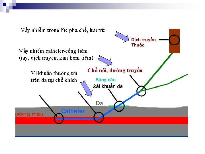 Vấy nhiễm trong lúc pha chế, lưu trữ Vấy nhiễm catheter/cổng tiêm (tay, dịch