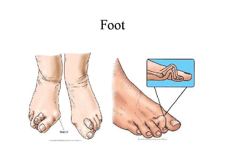 Foot 