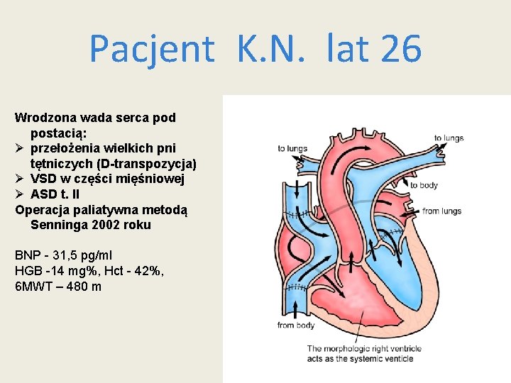 Pacjent K. N. lat 26 Wrodzona wada serca pod postacią: Ø przełożenia wielkich pni Pacjent K. N. lat 26 Wrodzona wada serca pod postacią: Ø przełożenia wielkich pni