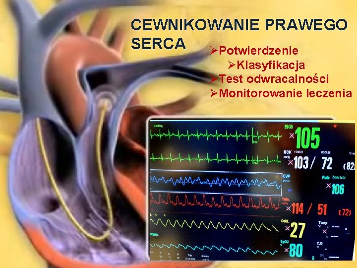 CEWNIKOWANIE PRAWEGO SERCA ØPotwierdzenie ØKlasyfikacja ØTest odwracalności ØMonitorowanie leczenia 