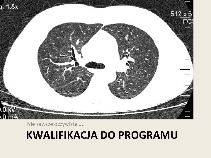 Nie zawsze oczywista…. . KWALIFIKACJA DO PROGRAMU 