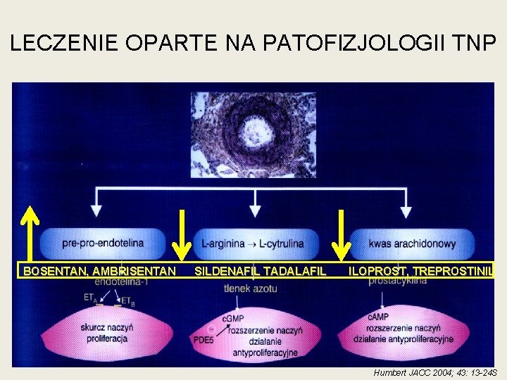 LECZENIE OPARTE NA PATOFIZJOLOGII TNP • ` BOSENTAN, AMBRISENTAN SILDENAFIL TADALAFIL ILOPROST, TREPROSTINIL Humbert LECZENIE OPARTE NA PATOFIZJOLOGII TNP • ` BOSENTAN, AMBRISENTAN SILDENAFIL TADALAFIL ILOPROST, TREPROSTINIL Humbert