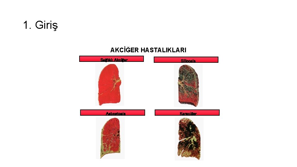 1. Giriş AKCİĞER HASTALIKLARI Sağlıklı Akciğer Asbestosis Silicosis Karaciğer 1. Giriş AKCİĞER HASTALIKLARI Sağlıklı Akciğer Asbestosis Silicosis Karaciğer
