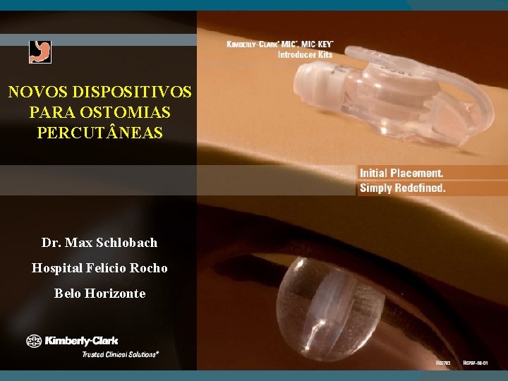 NOVOS DISPOSITIVOS PARA OSTOMIAS PERCUT NEAS Dr. Max Schlobach Hospital Felício Rocho Belo Horizonte