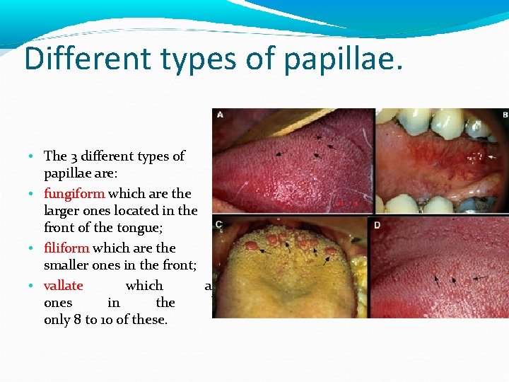 Different types of papillae. • The 3 different types of papillae are: • fungiform