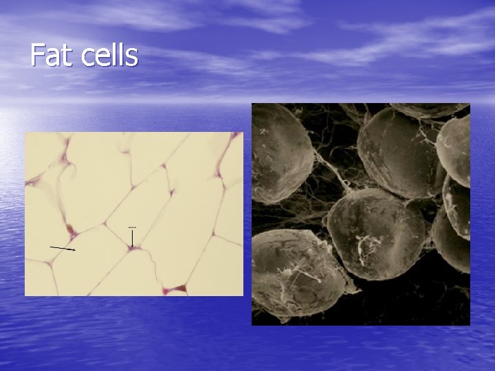 Fat cells 