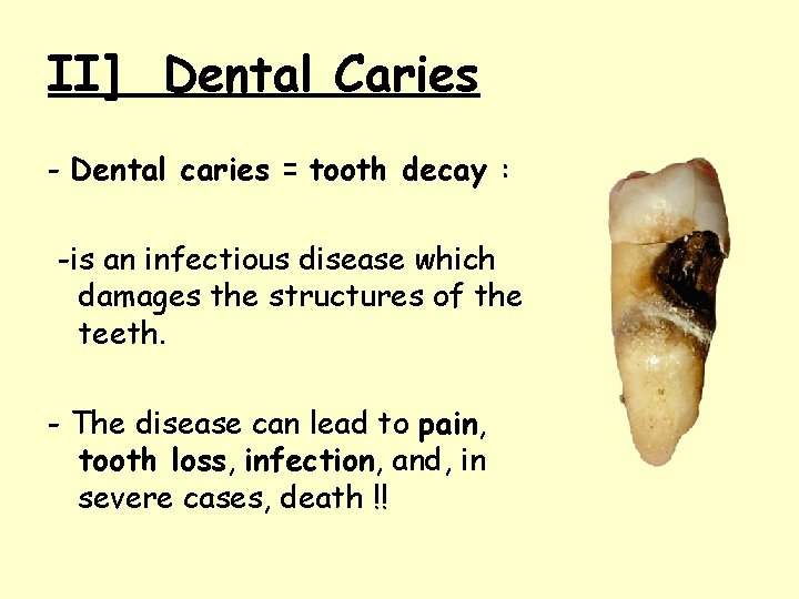 II] Dental Caries - Dental caries = tooth decay : -is an infectious disease