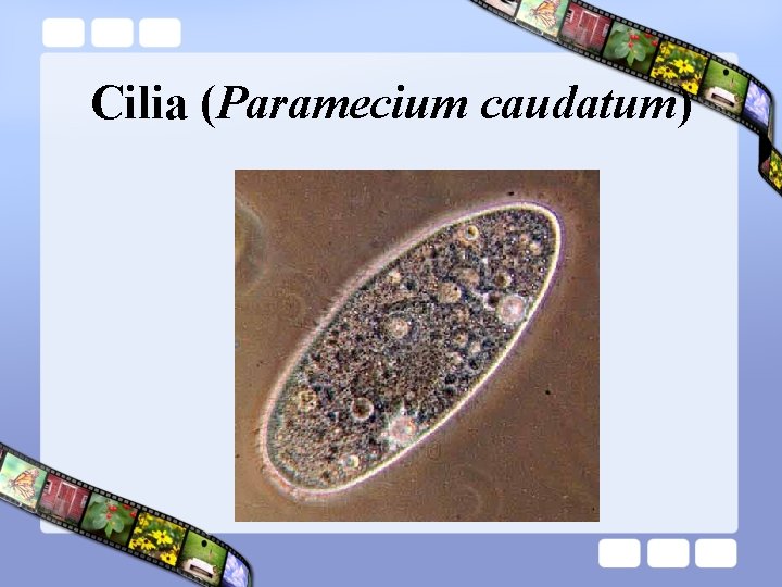 Cilia (Paramecium caudatum) 