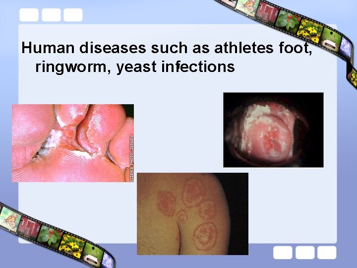 Human diseases such as athletes foot, , ringworm, yeast infections 